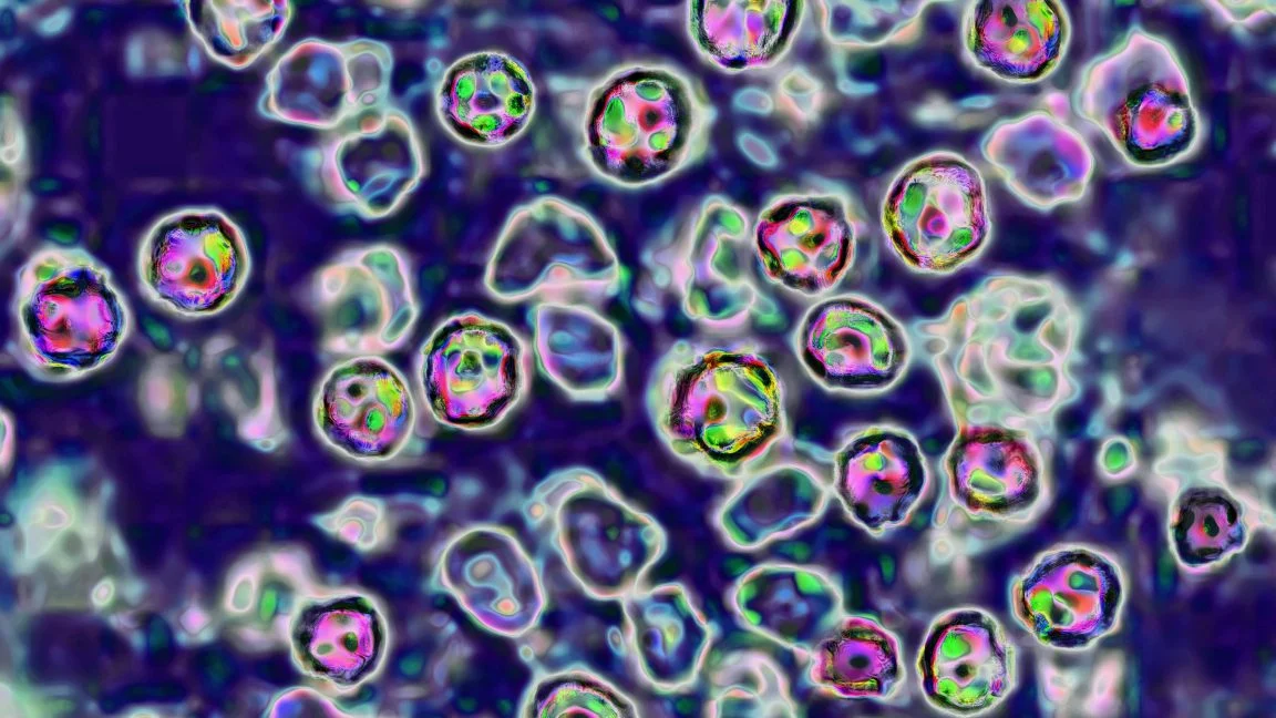 New Data Reveals Domestic Spread Fuels US Measles Surge While Contradicting Federal Health Official Claims
